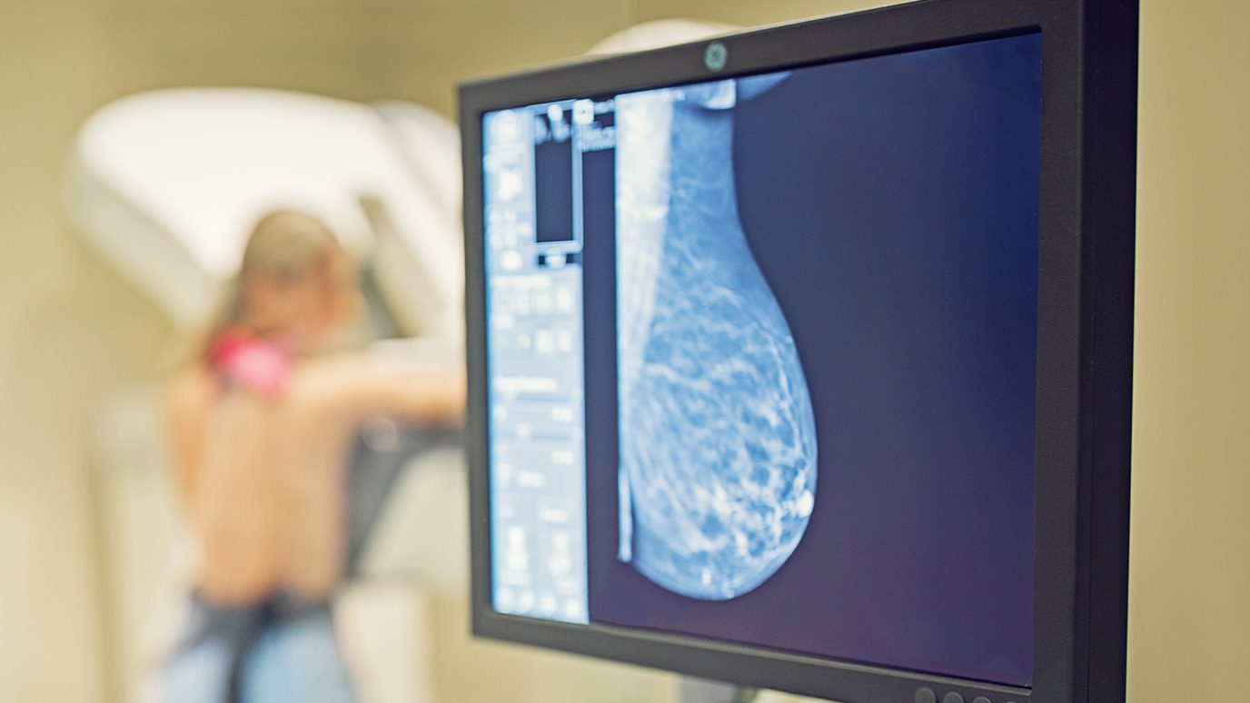 Breast cancer screening 