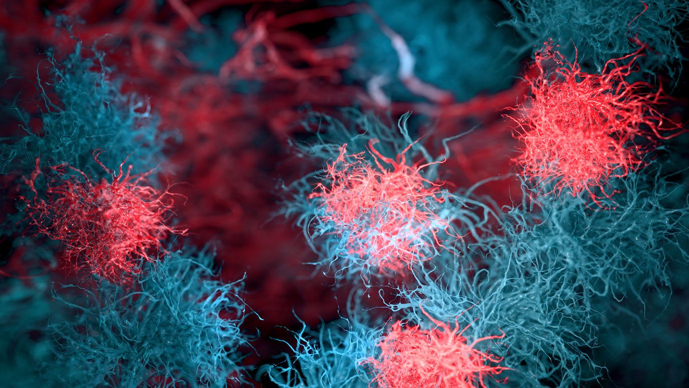 Abstract 3D illustration of a cancer spheroid with malignant cells and dendritic processes, scientific visualization of tumor growth 
