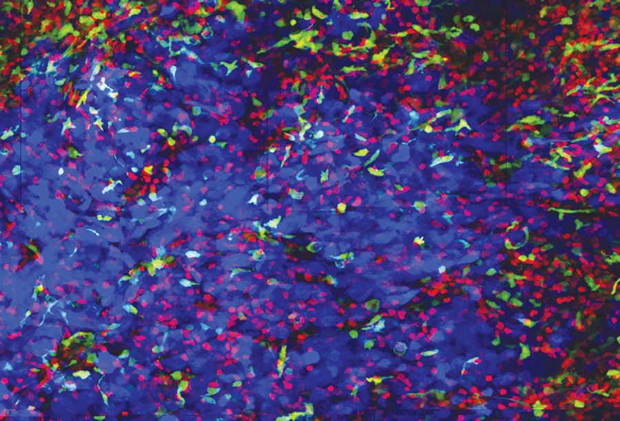 Amy B. Heimberger, M.D., Brain Tumor Physician-Scientist ...