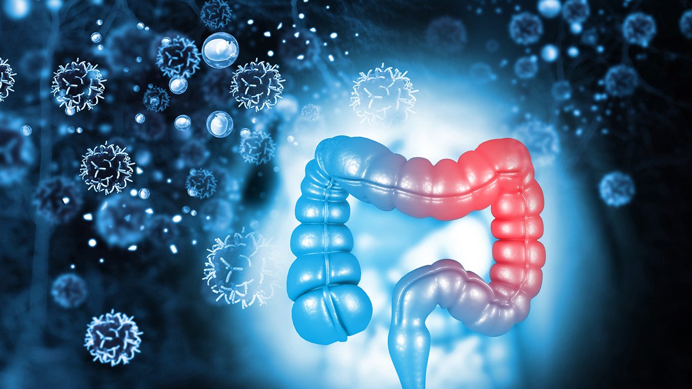 Colon surrounded by cancer cells