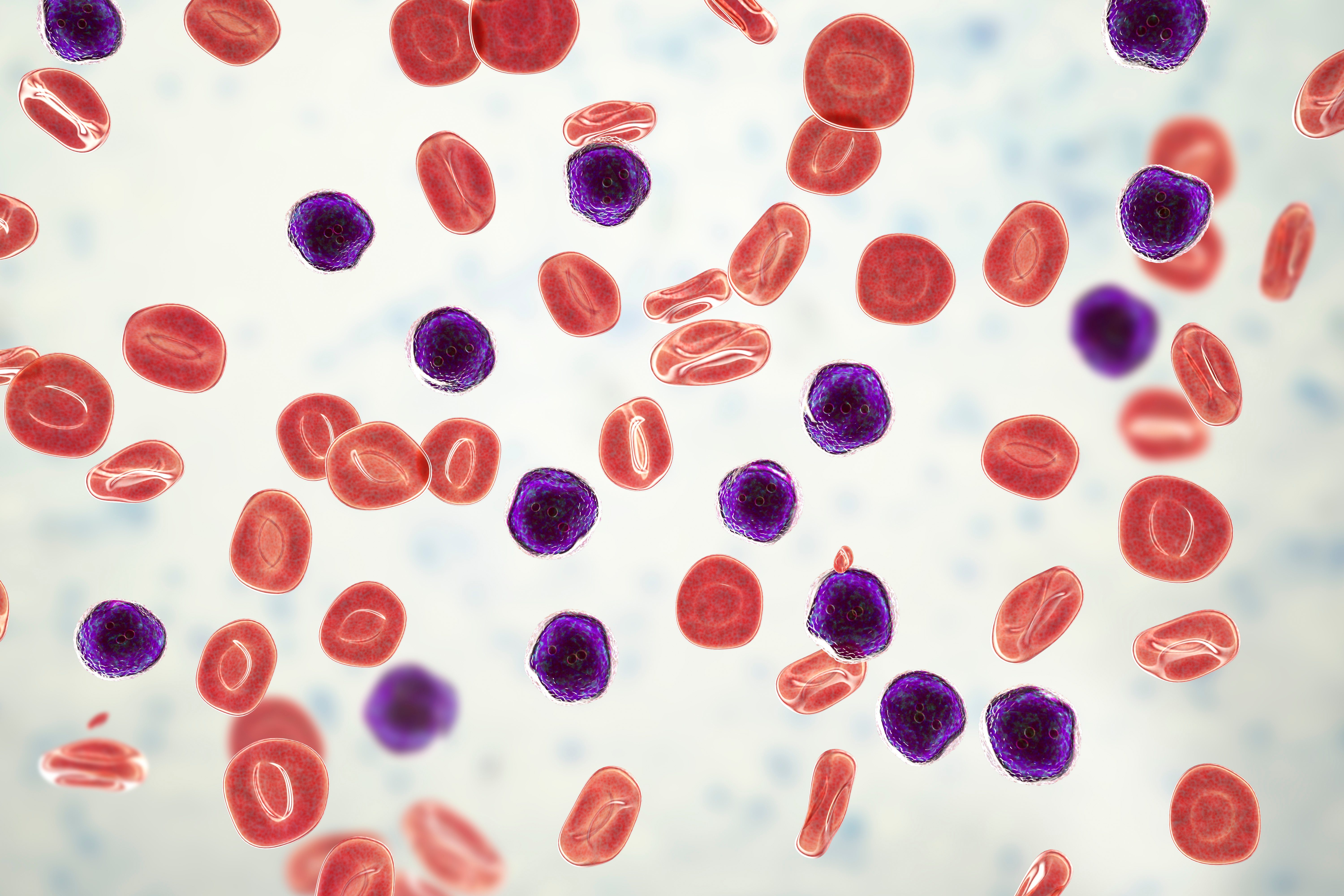 Picture of AML cells 