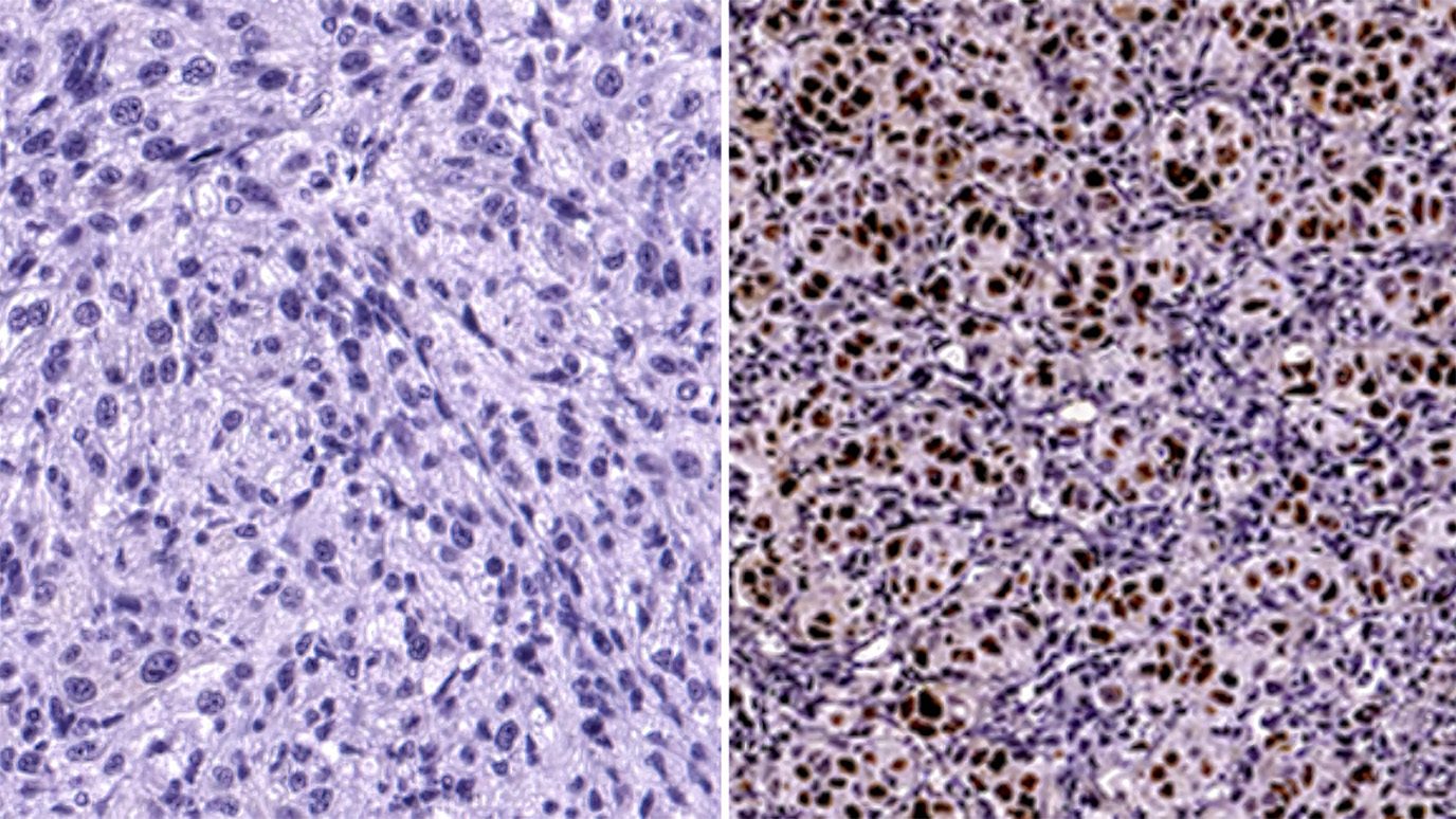 Immunohistochemistry slides showing the difference in expression of p21 between treatments