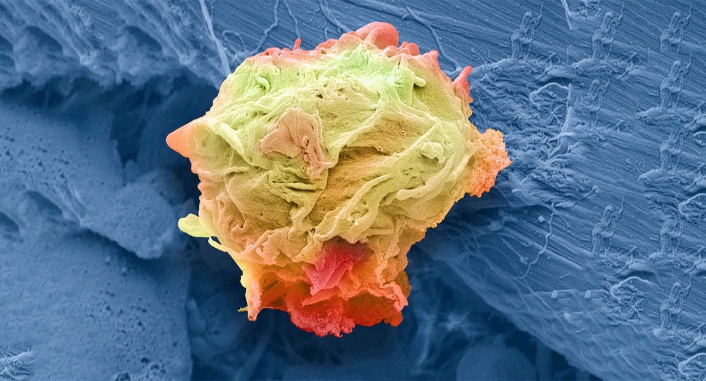 3D rendering of a cancer cell