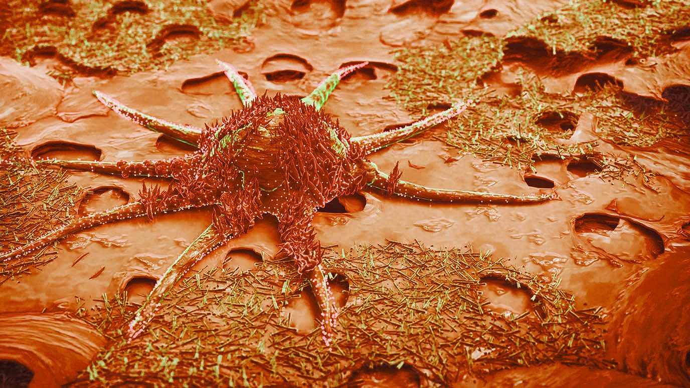 3D rendering of a cancer cell