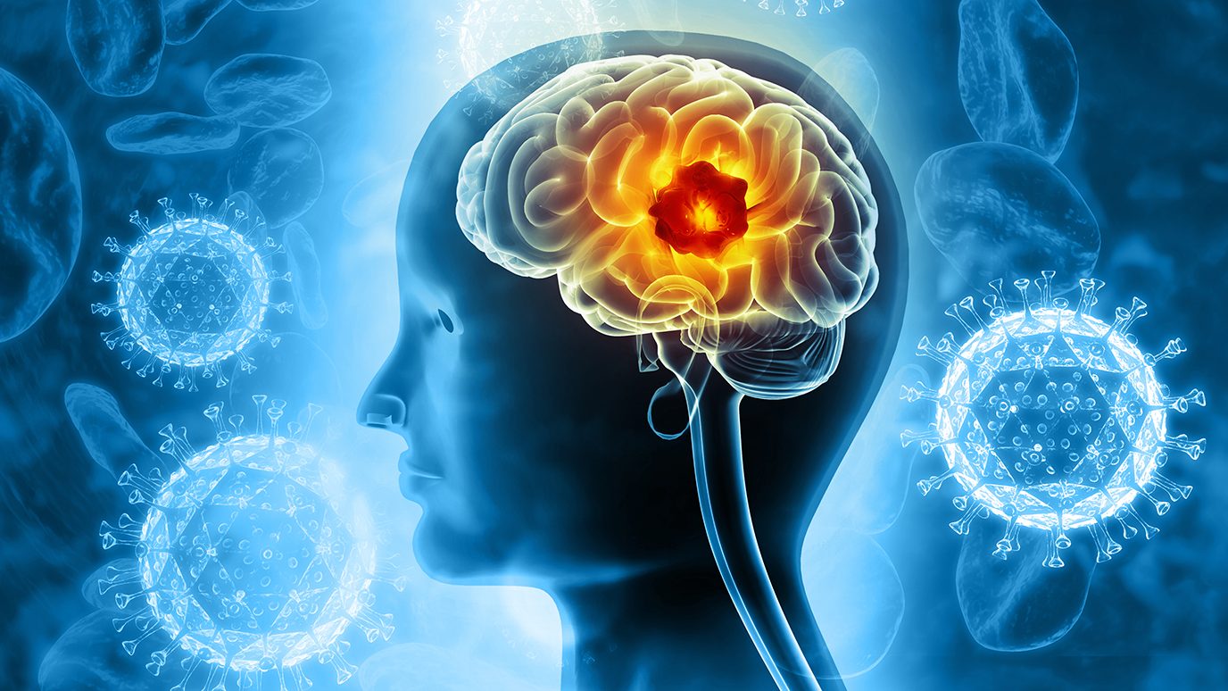 Image of brain with tumor inside of a human head surrounded by viruses