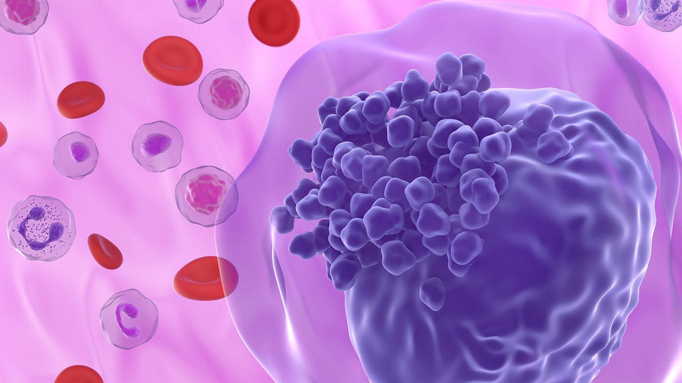 image of AML