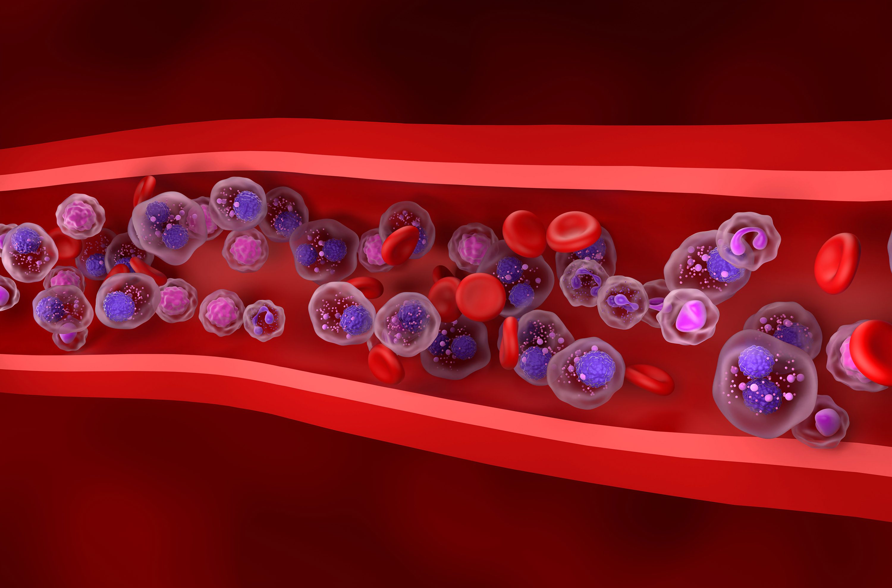 Image of multiple myeloma in bloodstream