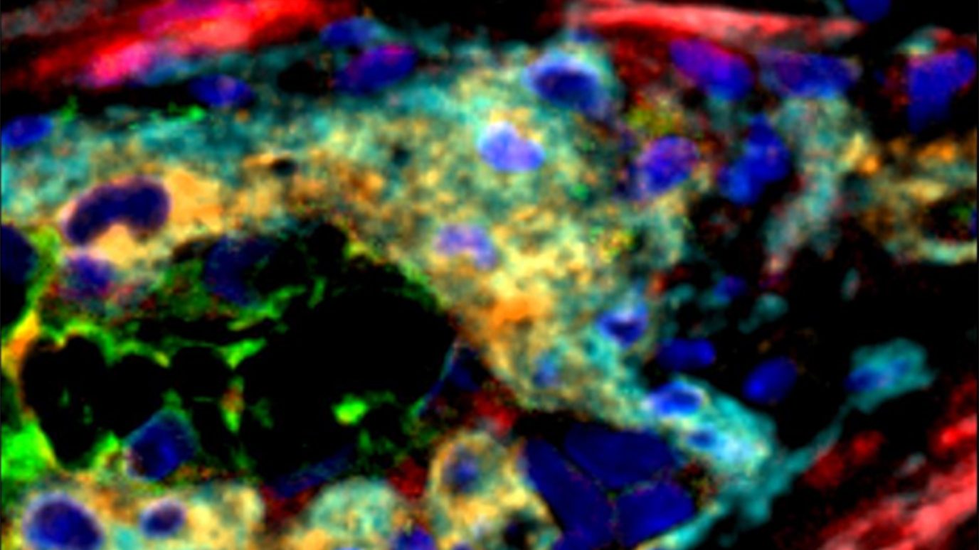 Multiple markers (red, orange, green and cyan) for mesenchymal stem cells around the blood vessels. Image courtesy of the Immunotherapy Platform, James P. Allison Institute.