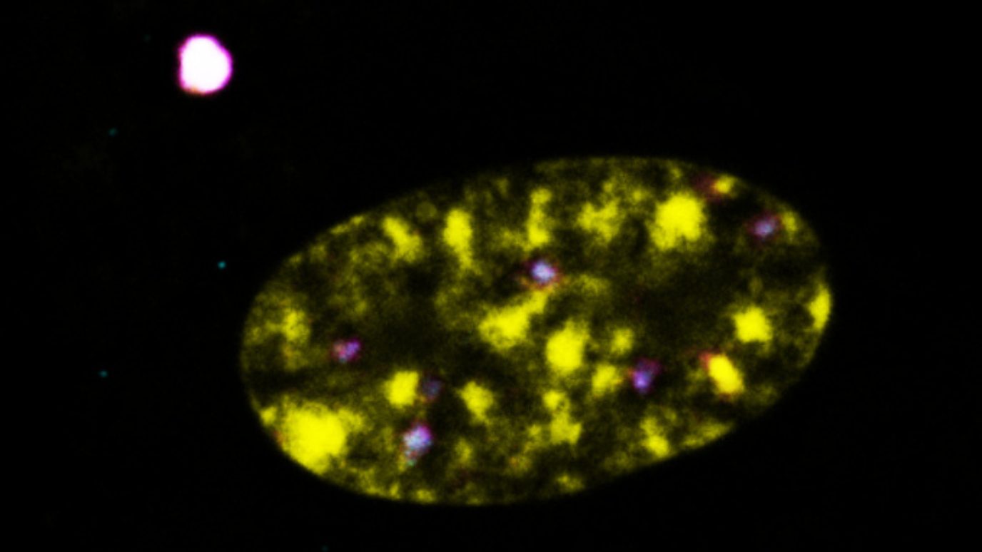 A cell nucleus appears as a yellow oval, with purple areas indicating R-loops. A purple and white dot outside the nucleus shows an exported R-loop.