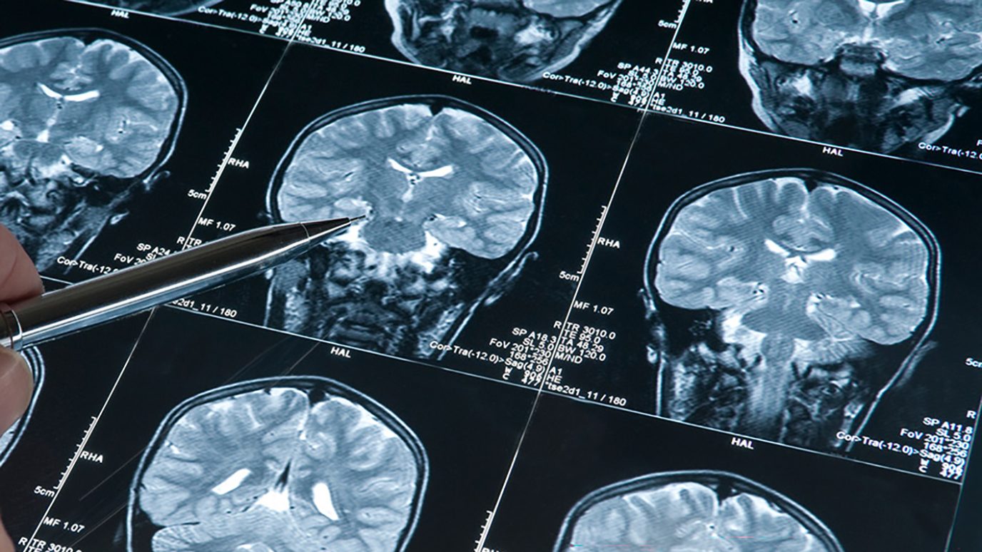 Multiple brain scans in one picture