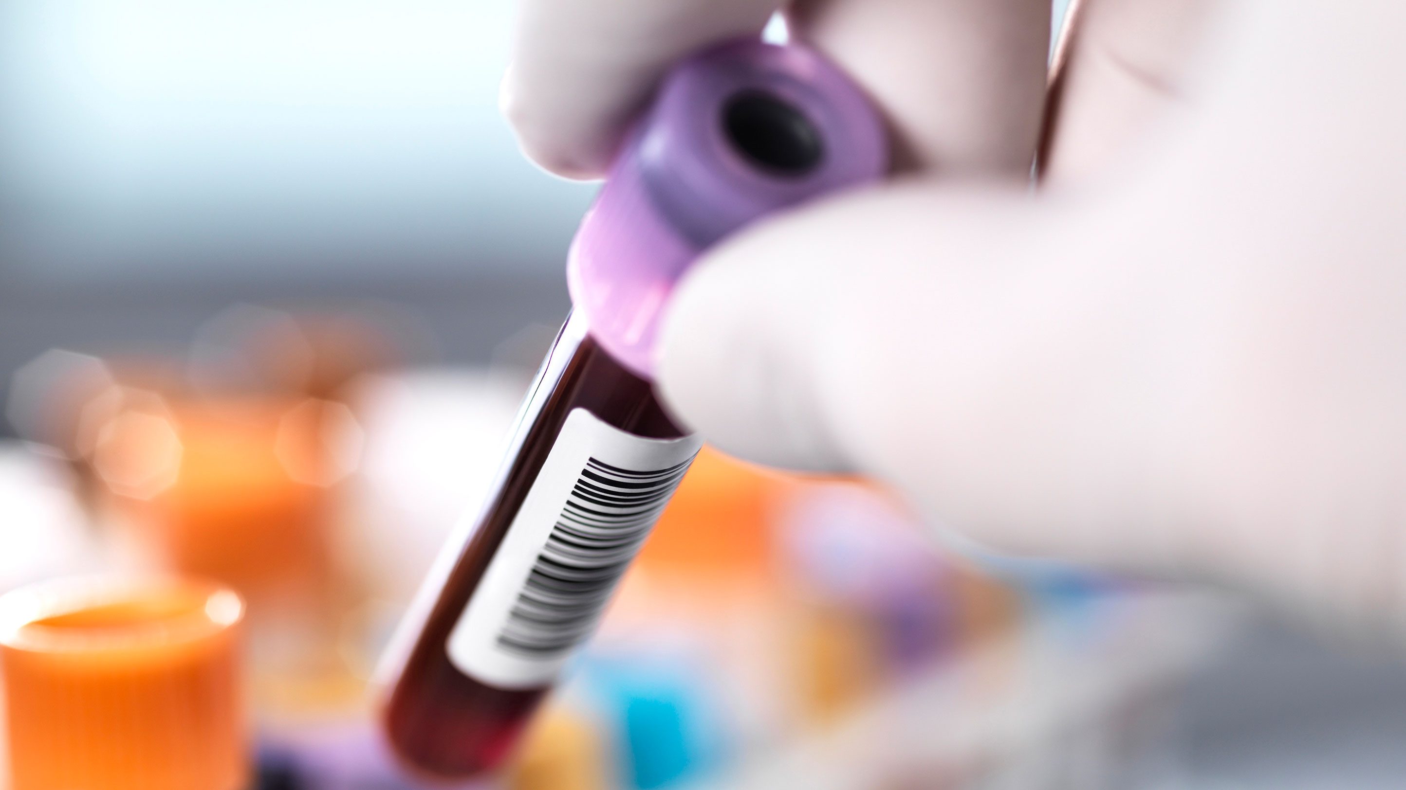 Picture of a vial of blood