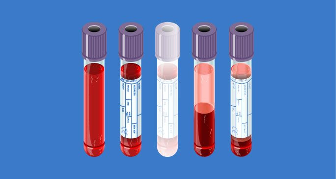 Graphic of five upright blood vials with different colored contents, stoppers and labels 