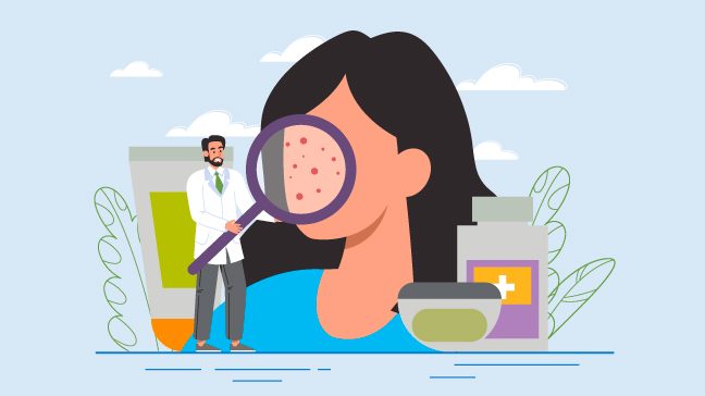 Tiny cartoon doctor holds oversized magnifying glass up to acne on woman's face