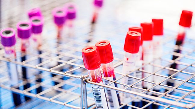 Vials of blood with red and purple caps