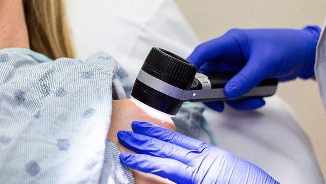 Gloved hands hold a black dermatoscope tool to a woman's shoulder.