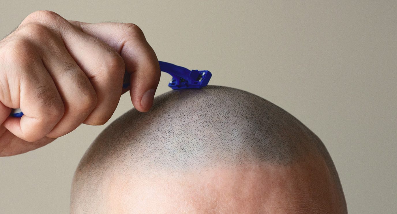 A person runs a razor across the top of their already bald head