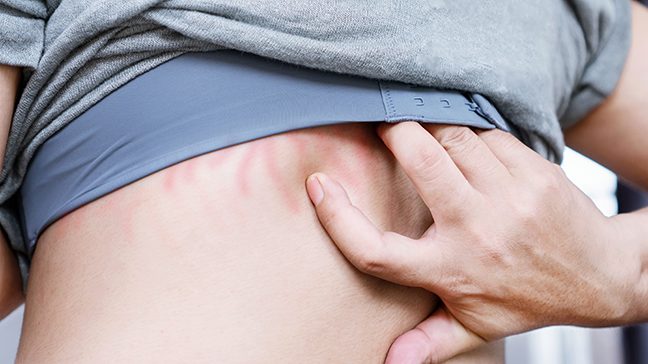 Close-up of unidentified white woman scratching her back beneath a sports bra